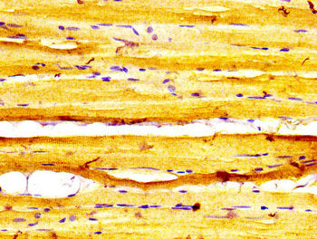 IHC image of CSB-PA717389LA01HU diluted at 1:600 and staining in paraffin-embedded human skeletal muscle tissue performed on a Leica BondTM system. After dewaxing and hydration, antigen retrieval was mediated by high pressure in a citrate buffer (...