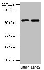 Western blot All lanes: STEAP3 antibody at 24µg/ml Lane 1: HepG2 whole cell lysate Lane 2: Hela whole cell lysate Secondary Goat polyclonal to rabbit IgG at 1/10000 dilution Predicted band size: 55, 56, 51 kDa Observed band size: 55 kDa