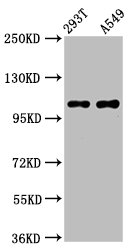 Western Blot Positive WB detected in: 293T whole cell lysate, A549 whole cell lysate All lanes: ICE2 antibody at 4.1µg/ml Secondary Goat polyclonal to rabbit IgG at 1/50000 dilution Predicted band size: 111, 9 kDa Observed band size: 111 kDa
