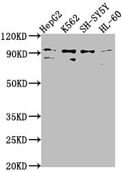 Western Blot Positive WB detected in: HepG2 whole cell lysate, K562 whole cell lysate, SH-SY5Y whole cell lysate, HL-60 whole cell lysate All lanes: NUGGC antibody at 1:2000 Secondary Goat polyclonal to rabbit IgG at 1/50000 dilution Predicted ban...