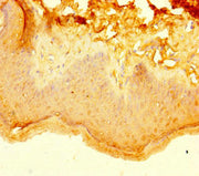 Immunohistochemistry of paraffin-embedded human skin tissue using CSB-PA718197LA01HU at dilution of 1:100