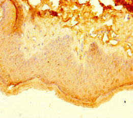 Immunohistochemistry of paraffin-embedded human skin tissue using CSB-PA718197LA01HU at dilution of 1:100