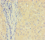 Immunohistochemistry of paraffin-embedded human liver tissue using CSB-PA718200LA01HU at dilution of 1:100