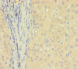 Immunohistochemistry of paraffin-embedded human liver tissue using CSB-PA718200LA01HU at dilution of 1:100