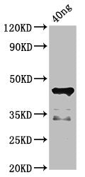 Western Blot Positive WB detected in Recombinant protein All lanes: ligA antibody at 4.5ug/ml Secondary Goat polyclonal to rabbit IgG at 1/50000 dilution Predicted band size: 45 kDa Observed band size: 45 kDa