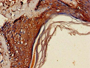 Immunohistochemistry of paraffin-embedded human skin tissue using CSB-PA718355LA01HU at dilution of 1:100