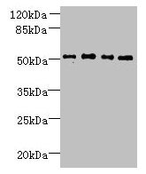Western blot All lanes: TTC38 antibody at 1.5µg/ml Lane 1: U251 whole cell lysate Lane 2: Mouse liver tissue Lane 3: HepG2 whole cell lysate Lane 4: K562 whole cell lysate Secondary Goat polyclonal to rabbit IgG at 1/10000 dilution Predicted band...