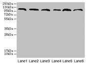 Western blot All lanes: CATSPERE antibody at 6µg/ml Lane 1: U87 whole cell lysate Lane 2: HepG2 whole cell lysate Lane 3: A549 whole cell lysate Lane 4: Mouse lung tissue Lane 5: Mouse liver tissue Lane 6: PC-3 whole cell lysate Secondary Goat pol...