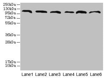 Western blot All lanes: CATSPERE antibody at 6µg/ml Lane 1: U87 whole cell lysate Lane 2: HepG2 whole cell lysate Lane 3: A549 whole cell lysate Lane 4: Mouse lung tissue Lane 5: Mouse liver tissue Lane 6: PC-3 whole cell lysate Secondary Goat pol...