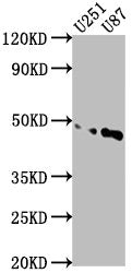 Western Blot Positive WB detected in: U251 whole cell lysate, U87 whole cell lysate All lanes: OTUD3 antibody at 1:1000 Secondary Goat polyclonal to rabbit IgG at 1/50000 dilution Predicted band size: 46 kDa Observed band size: 46 kDa