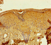 Immunohistochemistry of paraffin-embedded human skin tissue using CSB-PA719417LA01HU at dilution of 1:100