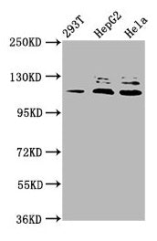 Western Blot Positive WB detected in: 293T whole cell lysate, HepG2 whole cell lysate, Hela whole cell lysate All lanes: MAP3K21 antibody at 3.3µg/ml Secondary Goat polyclonal to rabbit IgG at 1/50000 dilution Predicted band size: 114, 64, 53 kDa...