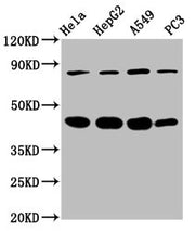 Western Blot Positive WB detected in: Hela whole cell lysate, HepG2 whole cell lysate, A549 whole cell lysate, PC-3 whole cell lysate All lanes: PIK3R6 antibody at 3.4µg/ml Secondary Goat polyclonal to rabbit IgG at 1/50000 dilution Predicted band...