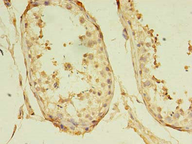 Immunohistochemistry of paraffin-embedded human testis tissue using CSB-PA719617LA01HU at dilution of 1:100