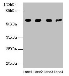 Western blot All lanes: KRT79 antibody at 1µg/ml Lane 1: Mouse lung tissue Lane 2: A549 whole cell lysate Lane 3: 293T whole cell lysate Lane 4: Mouse gonadal tissue Secondary Goat polyclonal to rabbit IgG at 1/10000 dilution Predicted band size:...