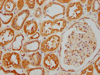 IHC image of CSB-PA720638LA01HU diluted at 1:400 and staining in paraffin-embedded human kidney tissue performed on a Leica BondTM system. After dewaxing and hydration, antigen retrieval was mediated by high pressure in a citrate buffer (pH 6.0)....