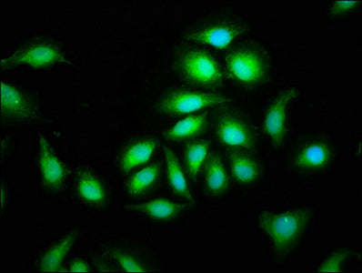 Immunofluorescence staining of A549 cells with CSB-PA721063LA01HU at 1:100, counter-stained with DAPI. The cells were fixed in 4% formaldehyde, permeabilized using 0.2% Triton X-100 and blocked in 10% normal Goat Serum. The cells were then incubat...