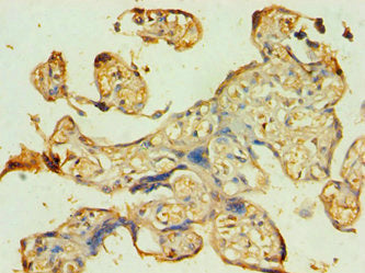 Immunohistochemistry of paraffin-embedded human placenta tissue using CSB-PA721119ESR1HU at dilution of 1:100