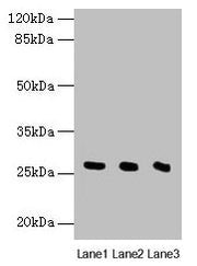 Western blot All lanes: Nqo2 antibody at 8µg/ml Lane 1: Rat heart tissue Lane 2: Mouse liver tissue Lane 3: Mouse kidney tissue Secondary Goat polyclonal to rabbit IgG at 1/10000 dilution Predicted band size: 27 kDa Observed band size: 27 kDa