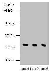 Western blot All lanes: Nqo2 antibody at 8µg/ml Lane 1: Rat heart tissue Lane 2: Mouse liver tissue Lane 3: Mouse kidney tissue Secondary Goat polyclonal to rabbit IgG at 1/10000 dilution Predicted band size: 27 kDa Observed band size: 27 kDa