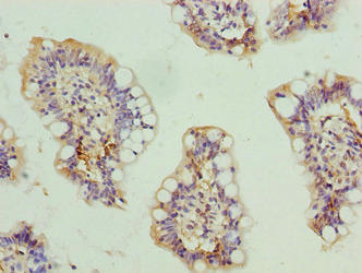 Immunohistochemistry of paraffin-embedded human small intestine tissue using CSB-PA721489LA01HU at dilution of 1:100