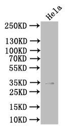 Western Blot Positive WB detected in: Hela whole cell lysate All lanes: PVRIG antibody at 1:1000 Secondary Goat polyclonal to rabbit IgG at 1/50000 dilution Predicted band size: 35 kDa Observed band size: 35 kDa