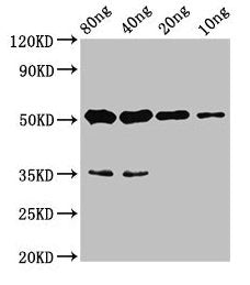 Western Blot Positive WB detected in Recombinant protein All lanes: cyp26b1 antibody at 4.4µg/ml Secondary Goat polyclonal to rabbit IgG at 1/50000 dilution Predicted band size: 46 kDa Observed band size: 51 kDa