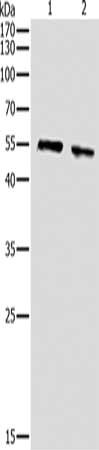 Gel: 10%SDS-PAGE, Lysate: 30ug, Lane 1-2: NIH/3T3 cells, Hela cells, Primary antibody: CSB-PA721992(pan-AKT Antibody) at dilution 1/500, Secondary antibody: Goat anti rabbit IgG at 1/8000 dilution, Exposure time: 10 minutes
