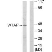Western blot analysis of extracts from HUVEC cells, using WTAP antibody.