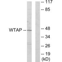 Western blot analysis of extracts from HUVEC cells, using WTAP antibody.