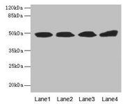 Western blot All lanes: TBCEL antibody at 12µg/ml Lane 1: Rat gonadal tissue Lane 2: PC-3 whole cell lysate Lane 3: Rat heart tissue Lane 4: 293T whole cell lysate Secondary Goat polyclonal to rabbit IgG at 1/10000 dilution Predicted band size: 49...