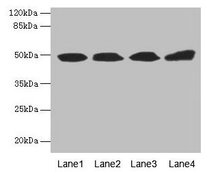 Western blot All lanes: TBCEL antibody at 12µg/ml Lane 1: Rat gonadal tissue Lane 2: PC-3 whole cell lysate Lane 3: Rat heart tissue Lane 4: 293T whole cell lysate Secondary Goat polyclonal to rabbit IgG at 1/10000 dilution Predicted band size: 49...