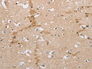 The image on the left is immunohistochemistry of paraffin-embedded Human brain tissue using CSB-PA722190(NCAN Antibody) at dilution 1/30, on the right is treated with synthetic peptide. (Original magnification: ×200)