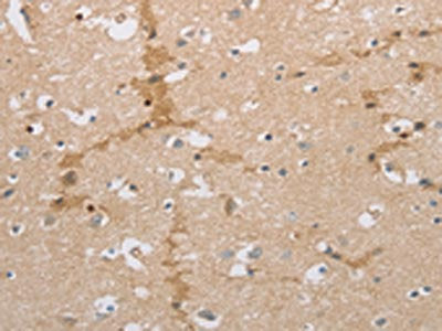 The image on the left is immunohistochemistry of paraffin-embedded Human brain tissue using CSB-PA722190(NCAN Antibody) at dilution 1/30, on the right is treated with synthetic peptide. (Original magnification: ×200)