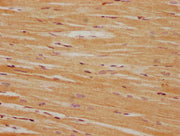 IHC image of CSB-PA722509LA01HU diluted at 1:100 and staining in paraffin-embedded human heart tissue performed on a Leica BondTM system. After dewaxing and hydration, antigen retrieval was mediated by high pressure in a citrate buffer (pH 6.0). S...