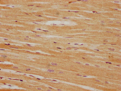 IHC image of CSB-PA722509LA01HU diluted at 1:100 and staining in paraffin-embedded human heart tissue performed on a Leica BondTM system. After dewaxing and hydration, antigen retrieval was mediated by high pressure in a citrate buffer (pH 6.0). S...