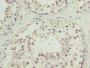 Immunohistochemistry of paraffin-embedded human testis tissue using CSB-PA722562LA01HU at dilution of 1:100