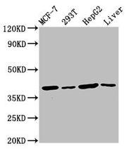 Western Blot Positive WB detected in: MCF-7 whole cell lysate, 293T whole cell lysate, HepG2 whole cell lysate, Mouse liver tissue All lanes: IBA57 antibody at 4.5µg/ml Secondary Goat polyclonal to rabbit IgG at 1/50000 dilution Predicted band siz...