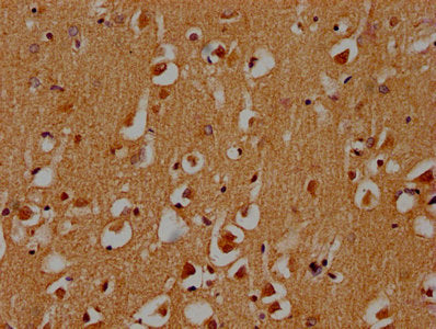 IHC image of CSB-PA722568LA01HU diluted at 1:300 and staining in paraffin-embedded human brain tissue performed on a Leica BondTM system. After dewaxing and hydration, antigen retrieval was mediated by high pressure in a citrate buffer (pH 6.0). S...