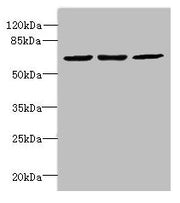 Western blot All lanes: INTS11 antibody at 2µg/ml Lane 1: Colo320 whole cell lysate Lane 2: Hela whole cell lysate Lane 3: MCF-7 whole cell lysate Secondary Goat polyclonal to Rabbit IgG at 1/10000 dilution Predicted band size: 68, 57, 66, 65, 69...