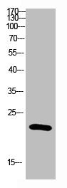 Western blot analysis of Hela Cell Lysate using antibody. Secondary antibody was diluted at 1:20000