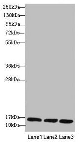 Western blot All lanes: REEP5 antibody at 1.02µg/ml Lane 1: MCF-7 whole cell lysate Lane 2: K562 whole cell lysate Lane 3: Hela whole cell lysate Secondary Goat polyclonal to rabbit IgG at 1/10000 dilution Predicted band size: 22, 15 kDa Observed...