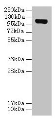 Western blot All lanes: DENND2C antibody at 8µg/ml + A431 whole cell lysate Secondary Goat polyclonal to rabbit IgG at 1/10000 dilution Predicted band size: 107, 95, 101 kDa Observed band size: 107 kDa
