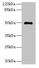 Western blot All lanes: ADAL antibody at 6µg/ml + Mouse kidney tissue Secondary Goat polyclonal to rabbit IgG at 1/10000 dilution Predicted band size: 41, 31, 38 kDa Observed band size: 50 kDa