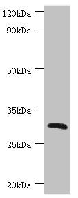 Western blot All lanes: C-type lectin domain family 12 member A antibody at 2ug/ml + Mouse skeletal muscle tissue Secondary Goat polyclonal to rabbit IgG at 1/10000 dilution Predicted band size: 31, 33, 9, 28, 25 kDa Observed band size: 31 kDa