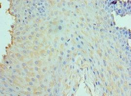 Immunohistochemistry of paraffin-embedded human tonsil tissue using CSB-PA725176ESR2HU at dilution of 1:100