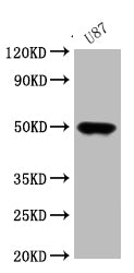 Western Blot Positive WB detected in: U87 whole cell lysate All lanes: ATAT1 antibody at 1：1000 Secondary Goat polyclonal to rabbit IgG at 1/50000 dilution Predicted band size: 45, 46, 47, 38, 37, 36, 34 kDa Observed band size: 47 kDa