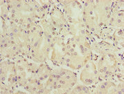 Immunohistochemistry of paraffin-embedded human gastric cancer using CSB-PA725558LA01HU at dilution of 1:100