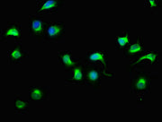 Immunofluorescence staining of A549 cells with CSB-PA725567LA01HU at 1:33, counter-stained with DAPI. The cells were fixed in 4% formaldehyde, permeabilized using 0.2% Triton X-100 and blocked in 10% normal Goat Serum. The cells were then incubate...