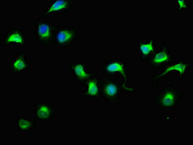 Immunofluorescence staining of A549 cells with CSB-PA725567LA01HU at 1:33, counter-stained with DAPI. The cells were fixed in 4% formaldehyde, permeabilized using 0.2% Triton X-100 and blocked in 10% normal Goat Serum. The cells were then incubate...